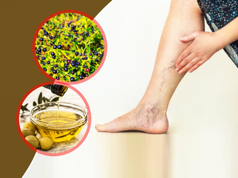 Overcoming Symptoms of Varicose Veins with Ayurveda