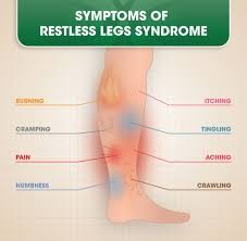 Link Between Varicose Veins and Restless Leg Syndrome