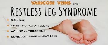 Link Between Varicose Veins and Restless Leg Syndrome