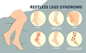 Link Between Varicose Veins and Restless Leg Syndrome