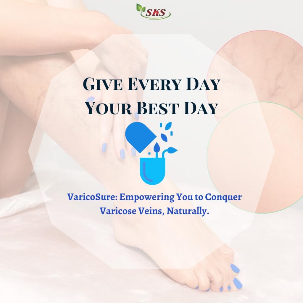 Lifestyle Factors Can Worsen Varicose Veins